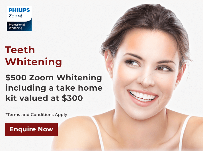 zoom whitening offer banner dentist belmont