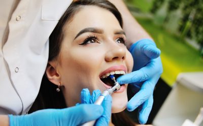 How Long Do Tooth Fillings Last?