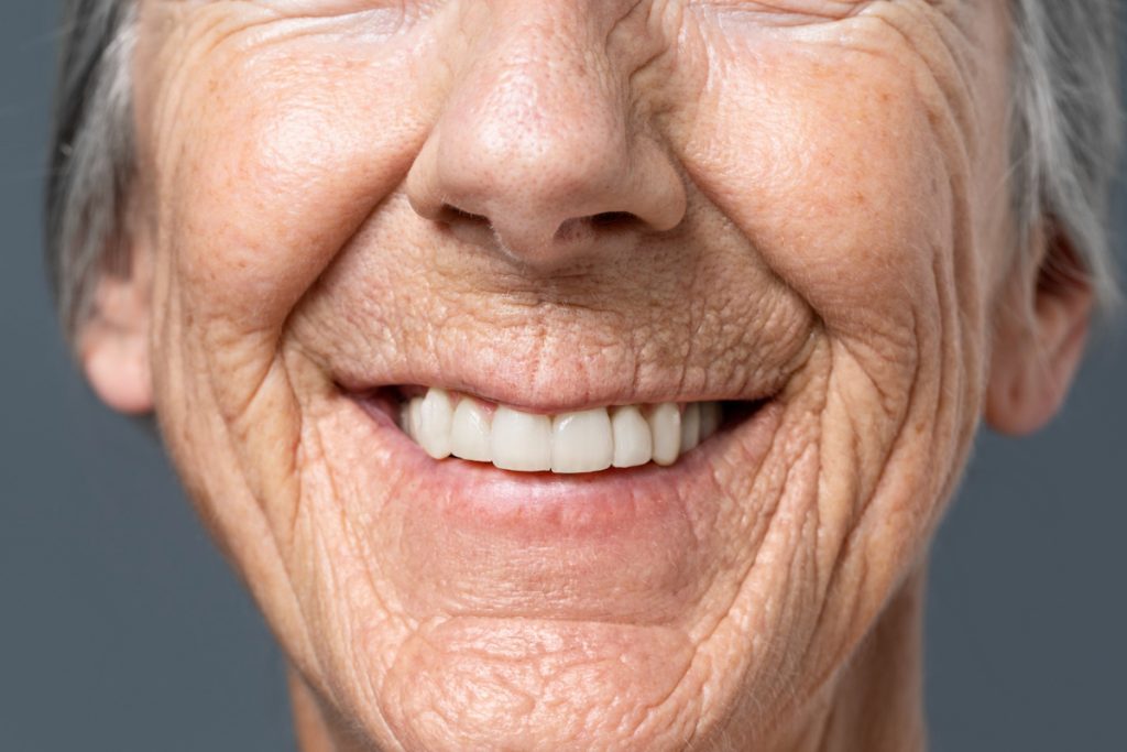 all-on-4 or traditional dental implants